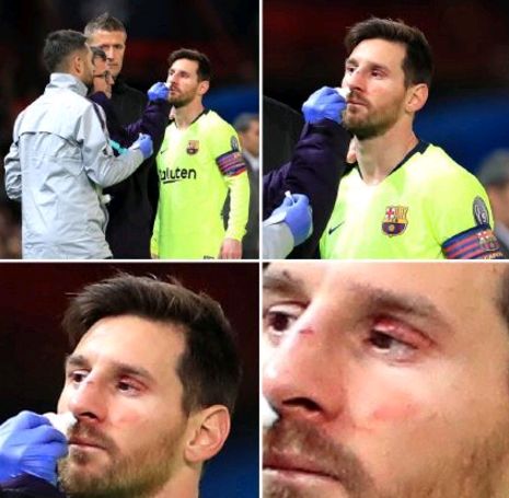 关于荷兰爆冷瑞典，阿尔巴高光表现的信息